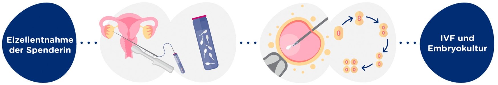 Eizellentnahme der Spenderin + Samenprobe<br><i>In-Vitro</i>-Befruchtung + 5 Tage Embryokultur