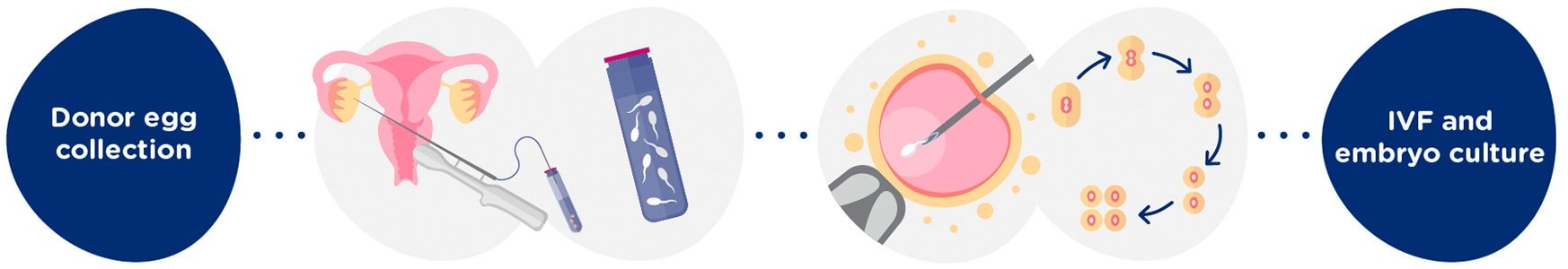 Egg collection + sperm sample<br><i>In Vitro</i> fertilisation + embryo culture