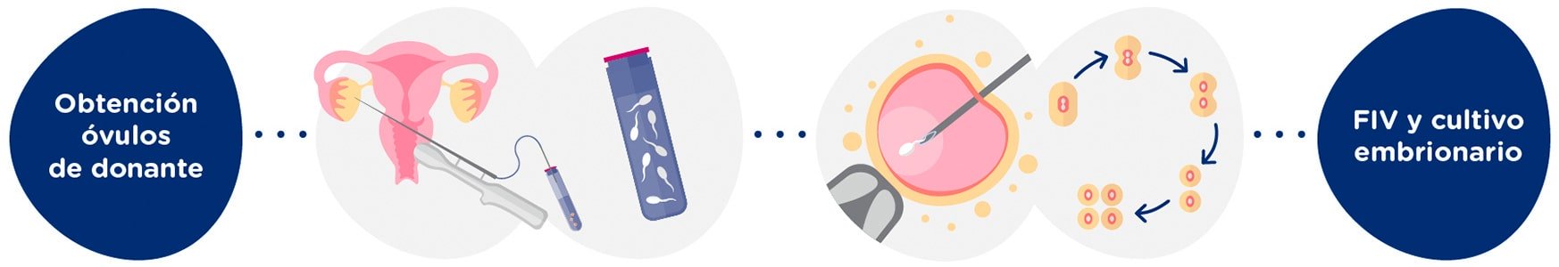 Obtención de óvulos de donante + muestra de semen<br>
Fecundación <i>in Vitro</i> + embriones en cultivo 5 días