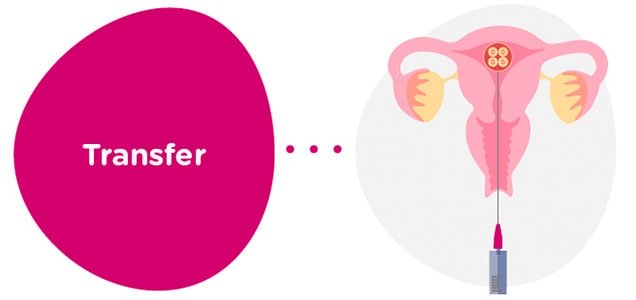 Embryo transfer