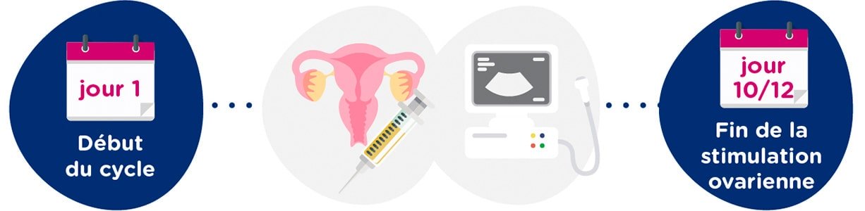 Stimulation ovarienne + examens gynécologiques
