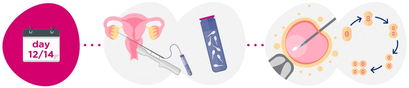Donor egg collection + sperm sample