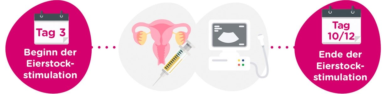 Eierstockstimulation + gynäkologische Untersuchungen