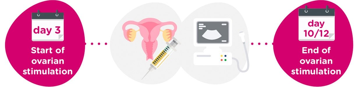 Ovarian stimulation + gynaecological tests