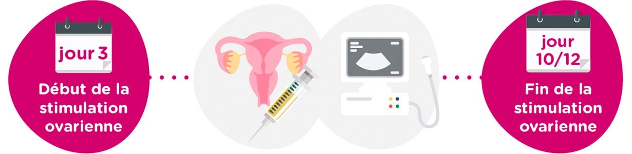 Stimulation ovarienne + examens gynécologiques