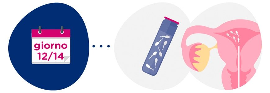 Preparazione campione di sperma + inseminazione