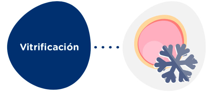 Vitrificación de óvulos