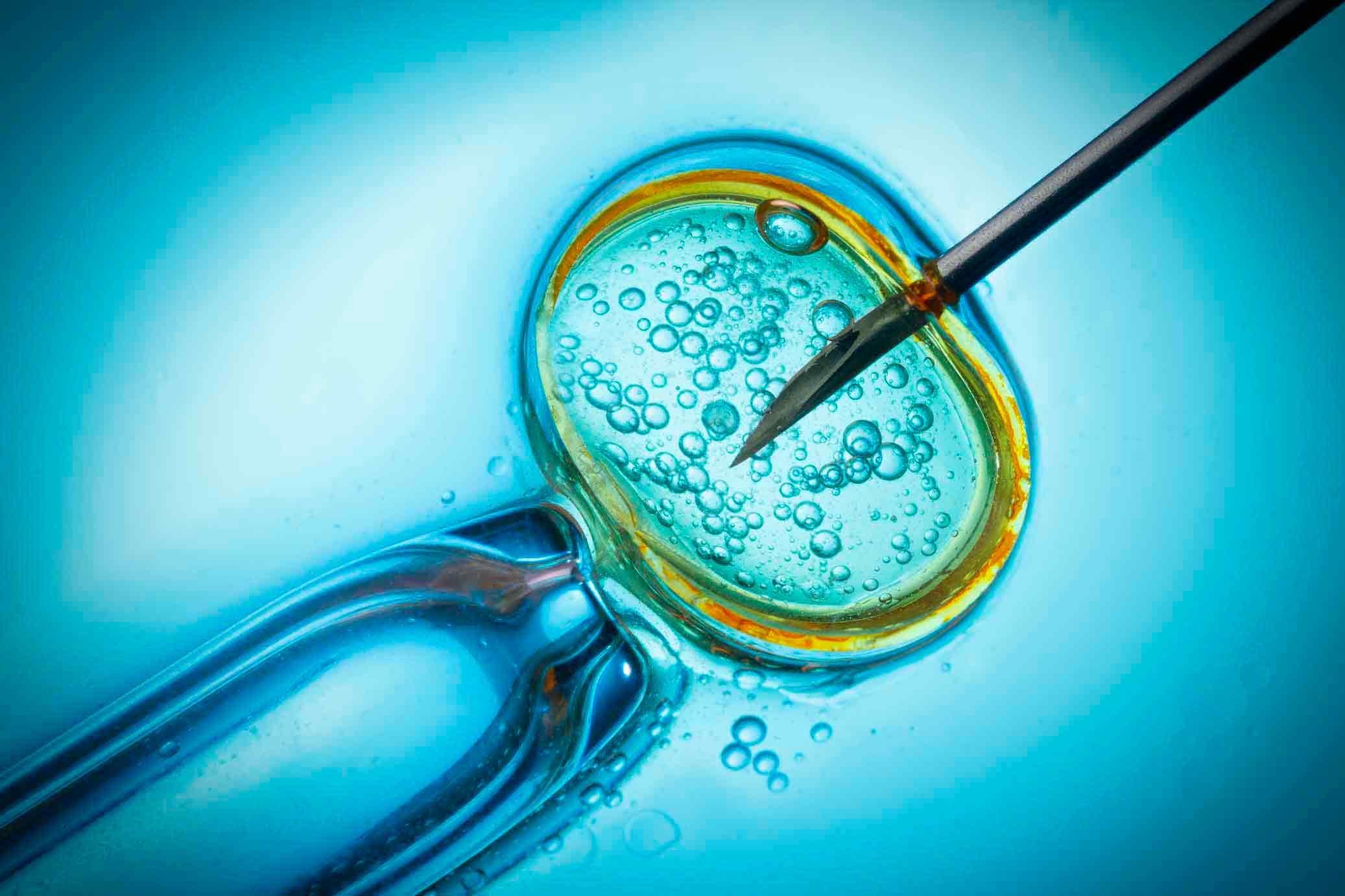 In vitro fertilisation, IVF macro concept