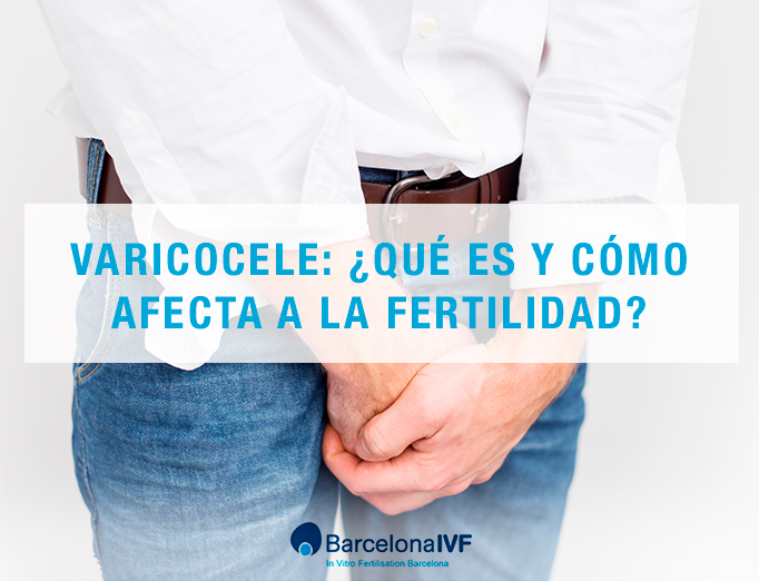 Soluciones para lograr el embarazo si se padece varicocele.