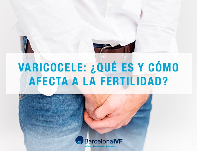 Soluciones para lograr el embarazo si se padece varicocele.