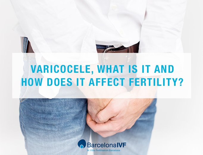 Varicocele: how does it affect fertility?